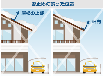 雪止めの誤った位置